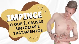 Impinge - o que é, causas, sintomas e tratamentos