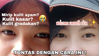 TIPS MENGATASI KULIT GRADAKAN DAN KASAR MENJADI KULIT HALUS | IT'S DIANA