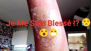 🌻 PRANK / JE FAIS CROIRE À MA COPINE QUE JE ME SUIS BLESSÉ ! 🤣