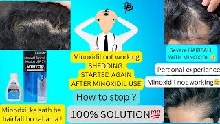 MINOXIDIL SHEDDING phase 2 / minoxidil not working / hair shedding ! How to stop /Solution