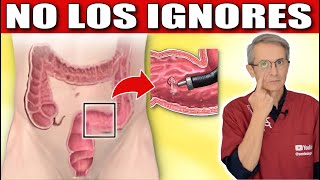 Signos TEMPRANOS de CÁNCER de COLON: NO los IGNORES