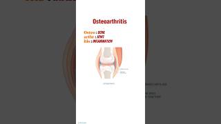 Osteoarthritis Causes, symptoms & treatment#osteoarthritis#jointpain #pathology#disease#medical#mbbs