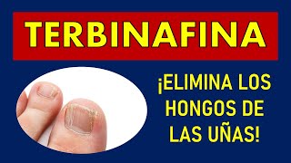 🔴 TERBINAFINA | PARA QUÉ SIRVE? ELIMINA LOS HONGOS DE LAS UÑAS