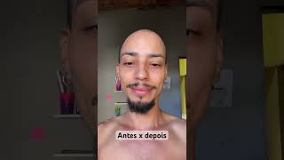 Antes e depois da barba