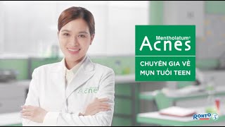 Acnes - Ra mắt thành viên mới, giải mã mọi vấn đề da tuổi dậy thì!