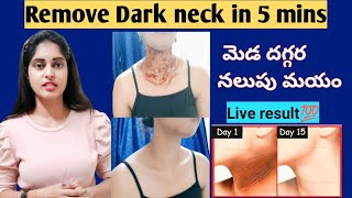 Dark Neck Home Remedy In Telugu 🤩 | Neck Whitening tip in telgu | How to Remove Dark Neck at Home