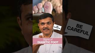 Keep your FEET happy: Diabetic Foot CARE Tips  #doctor #shortsviral