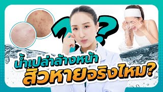 ใช้แค่น้ำเปล่าล้างหน้า สิวจะหายมั้ย?