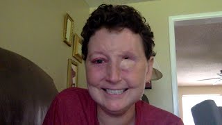 Preliminary Scan Results Update on my Cancer Journey