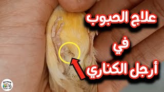 علاج أرجل الكناري من الحبوب والقشور والفطريات مع شرح طريقة قص الأظافر الصحيحة