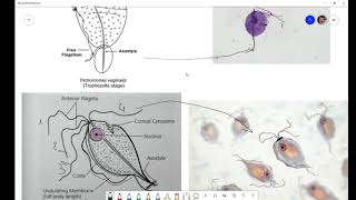 2 Topic 2. Trichomonas