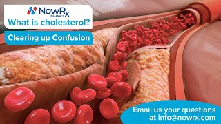 What is Cholesterol? Good and Bad Cholesterol Explained