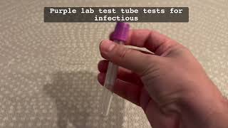 Lab test tube tops