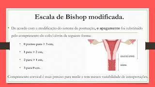 Escala de Bishop - você já utilizou?