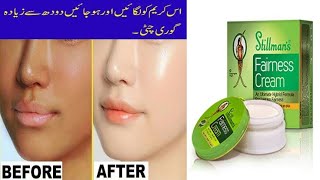 Best whitening cream/ whitening cream/medicated whitening cream