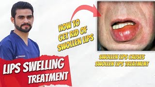 swollen lips treatment