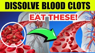 DON'T WORRY about BLOOD CLOTS - Eat these foods to dissolve blood clots naturally - Bestie Foods