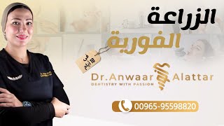 حالة جديدة لزراعة الفكين الفورية فى أقل من 10 أيام مع #الساحرة  الدكتورة أنوار العطار