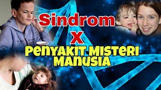 Sindrom X : Penyakit Misteri Yang Membuat Manusia Kekal awet Muda