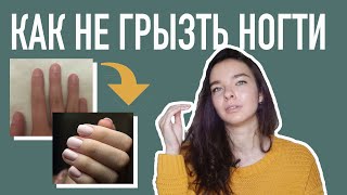 Как Избавиться? Я грызла ногти 20 лет