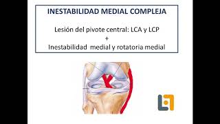 Semimembranosus advancement to treat rotatory instability