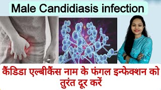 Male Candidiasis Infection| कैंडिडा एल्बीकैंस नाम के फंगल इन्फेक्शन को तुरंत दूर करें