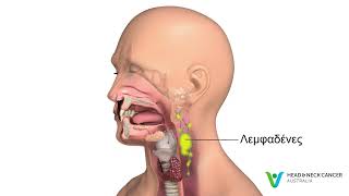 Greek - What is Sinus Cancer / Nasal Cancer? Signs & Symptoms. Head and Neck Cancer