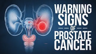 10 Warning Signs of Prostate Cancer