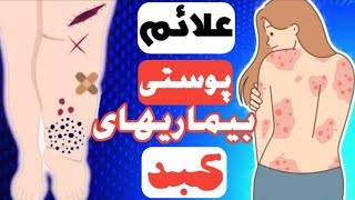 کافیه به پوست تون نگاه کنید تا از سلامت کبد(جگر) خود آگاه شوید