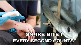 How to survive a SNAKE BITE ? secret of snake bite survival : Medical Tips