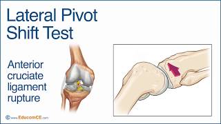 Pivot Shift Test  - YouTube