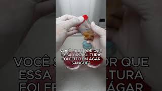 Como uma urocultura é feita no laboratório? #shorts #microbiologia