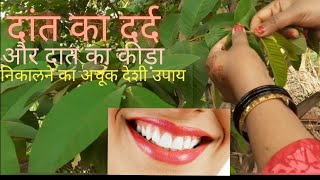 5 मिनट में दांत दर्द ख़त्म घरेलू इलाज/Home Remedy for Toothache/dard ka ilaj,दांतदर्द का रामबाण उपाय