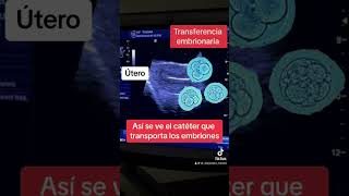 Transferencia de embriones #infertilitycauses #embarazo #fiv #infertilidad #bebe #invitro #pcos