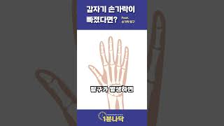 [1분나닥] 갑자기 손가락이 빠졌다면? Feat  손가락탈구