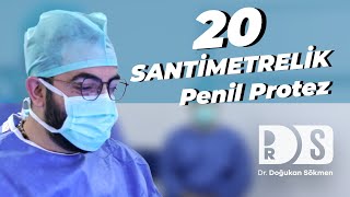 Tam 20 Santimetrelik Penil Protez Ameliyatı | Şehir Dışından Bizi Tercih Etti