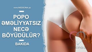 Popo əməliyyatsız necə böyüdülür? - Bakıda