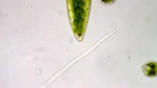 Barium Sulphate crystals at the tips of a Desmid