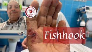 Emergency Fish Hook Removal; a modified technique