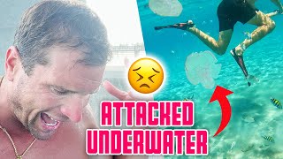 ATTACKED UNDER WATER | STUNG BY A JELLYFISH OVER 100 TIMES