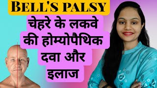 Bell's palsy | Top best homeopathic medicine for bell's palsy | Facial Paralysis