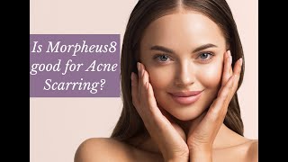 Is Morpheus8 good for Acne Scarring | The Cosmetic Skin Clinic