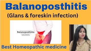 Balanoposthitis ! Glans & foreskin infection !Balanoposthitis symptoms,cause & homeopathic medicine