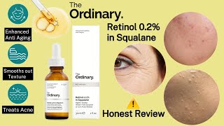 The Ordinary Retinol 0.2 in Squalane review ✨️|Best retinol serum | retinol for beginners