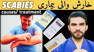 scabies in urdu/ hindi || cause, symptoms & treatment || kharish ka ilaj | खुजली