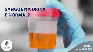 Sangue na urina é normal? | Chocair Médicos Associados