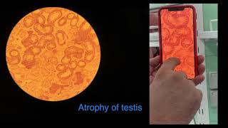 Pathology Lab 3 _ Cell Injury