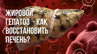 ЖИРОВОЙ ГЕПАТОЗ  -  как восстановить печень