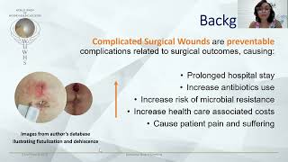 Carol Viviana:  Complicated Surgical Wounds Prevalence And Associated Factors