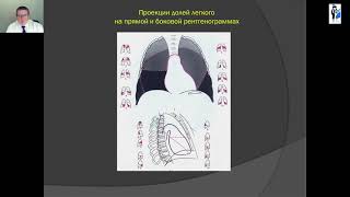 Лекция 6. Лучевая диагностика заболеваний легких . Часть 1. Лектор Капишников А.В.